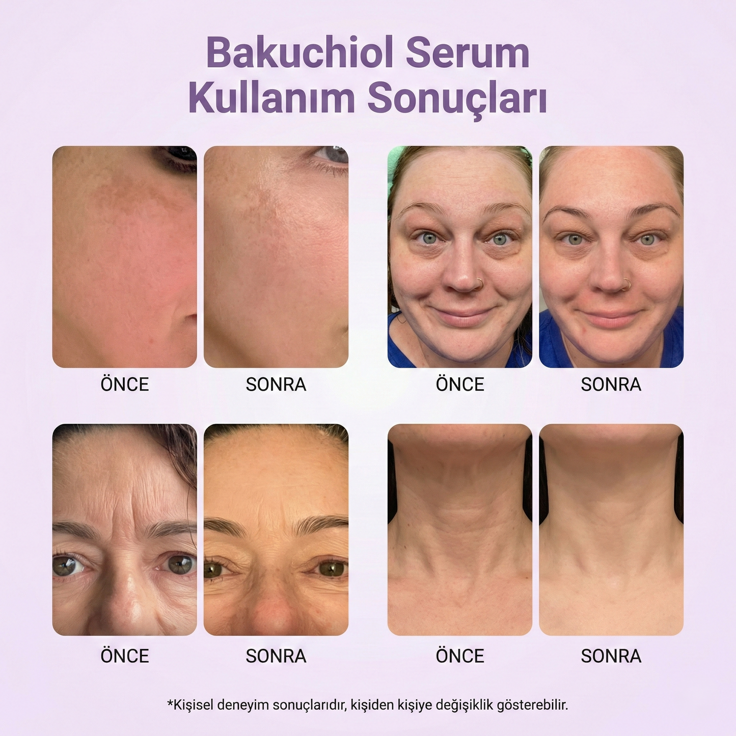 Viberry™ Bakuchiol Plumping Serum
